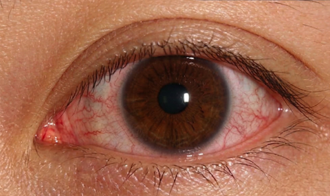 Normal Human retina 이미지