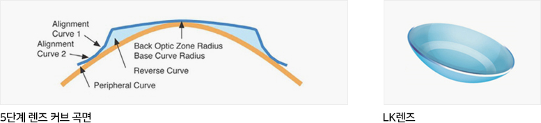 5단계 렌즈 커브 곡면, LK렌즈