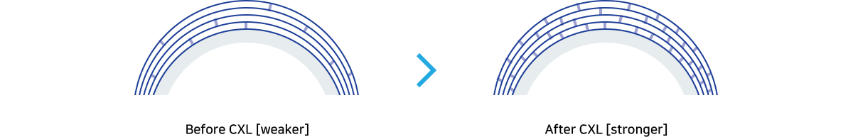 Before CXL [weaker], After CXL [stronger]