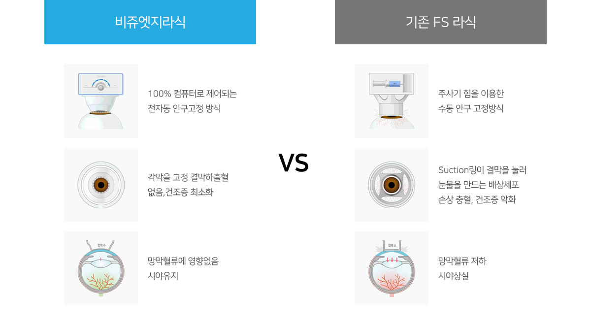 비쥬엣지라식 VS 기존 FS 라식