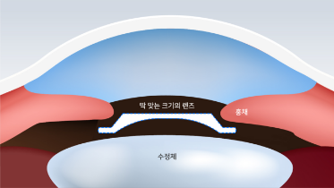 딱 맞는 크기의 렌즈