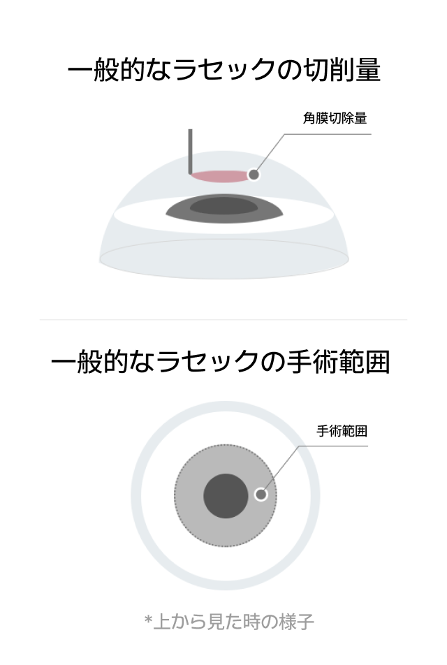 BGSS EYE CLINIC-밝은세상안과 서울l부산