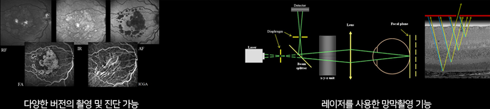 다양한 버전의 촬영 및 진단 가능, 레이저를 사용한 망막촬영 기능