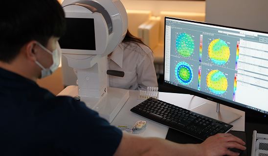 라식, 라섹 수술 후 백내장 수술 1